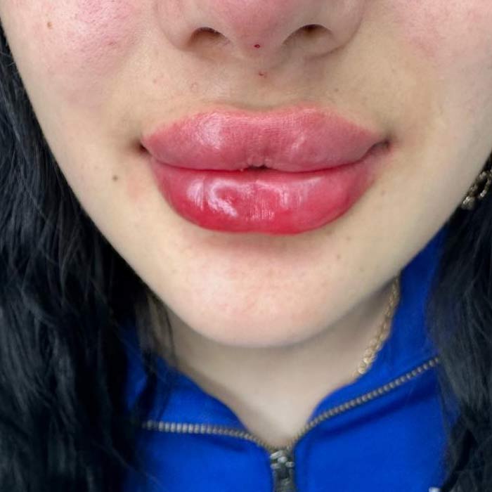 Labios Rusos