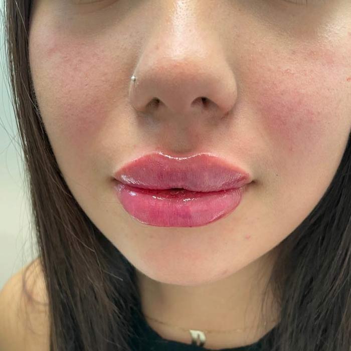 Labios Rusos